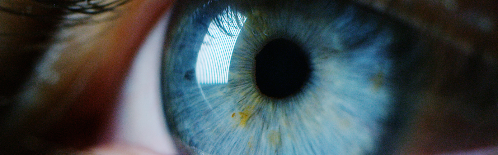 Eye